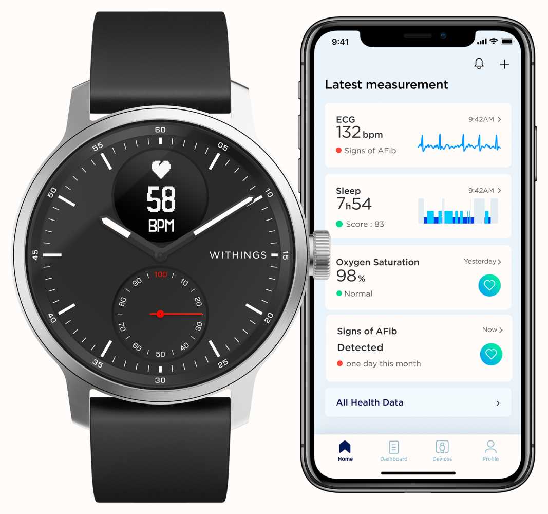 Withings-Scanwatch.jpg